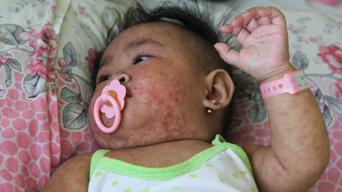 Decoder Replay Measles spread