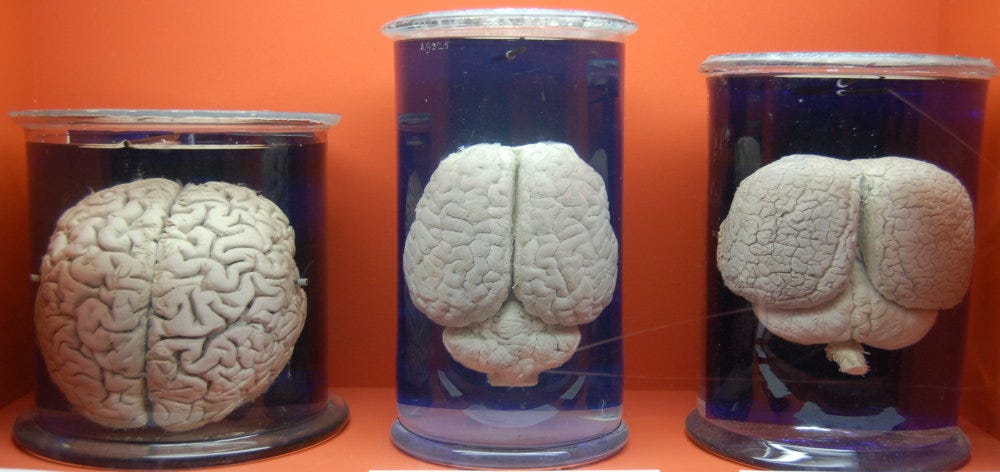 Miles Of Mosaics And Brains In Jars
